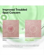 Azelaic Acid 3 Cica Skin Clarifying Toner - Image 5