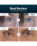 Dr. Melaxin Eyephalt Eyebag Cream - Image 6