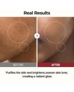 Dr. Melaxin Peel Shot Glow Rice Toner - Image 8